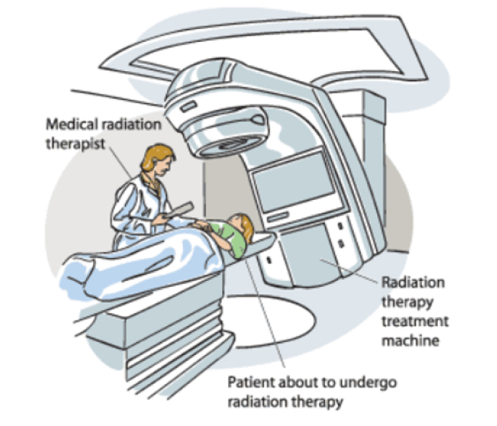 External Beam Radiation Therapy For Cancer