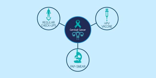 Cervical Cancer Treatment