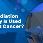 Radiation Therapy for Cancer