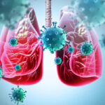 Lung cancer treatment