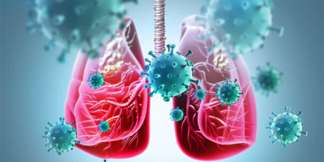 Lung cancer treatment