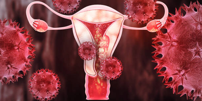 Uterus cancer treatment